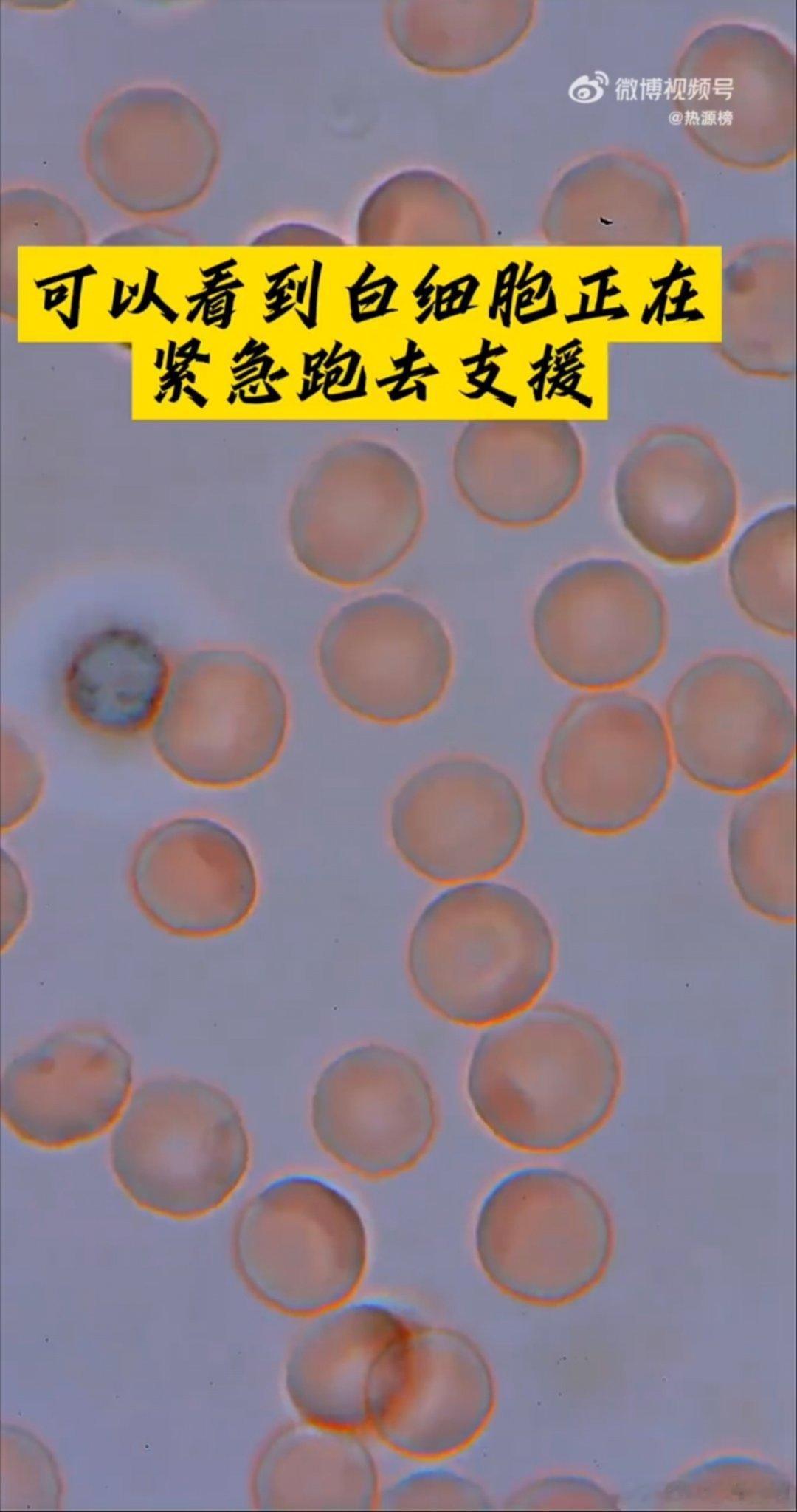 指尖血放大看我们每个人像不像白细胞？拼命的维护美好 ​​​