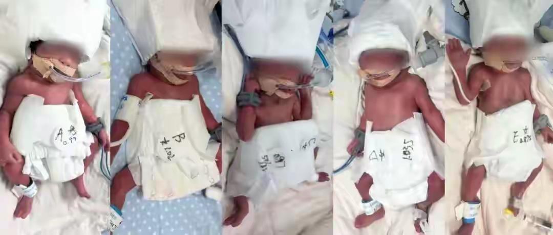 概率六千万分之一！新疆24岁产妇在武汉诞下“一兄四妹”五胞胎

今日凌晨3时许，