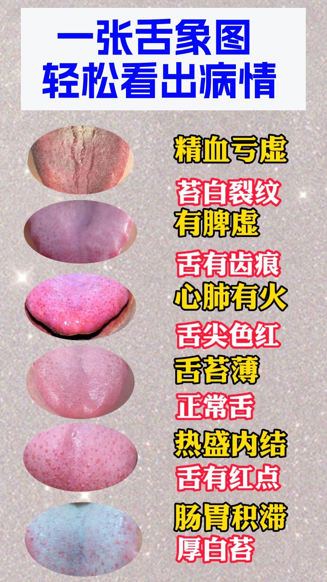 一张舌诊图，轻松知病情[中国赞][中国赞][中国赞]
你的舌头有几种特征？2分钟