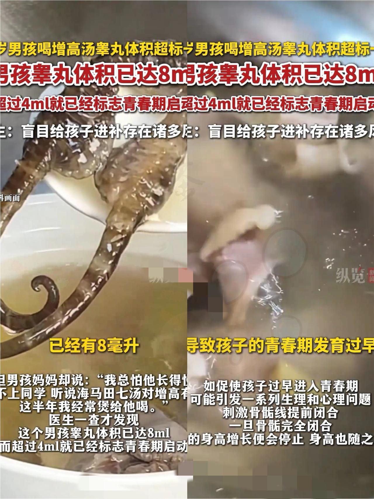 怕啥来啥！广东佛山有位妈妈为了让11岁儿子长到175，天天熬海马田七汤，结果身高