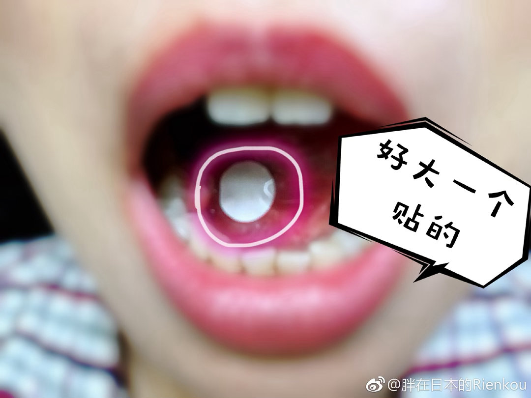 以前我非常时常口腔溃疡自从老公生病我们开始多吃蔬果后我就几乎没再口腔溃疡了【搬运