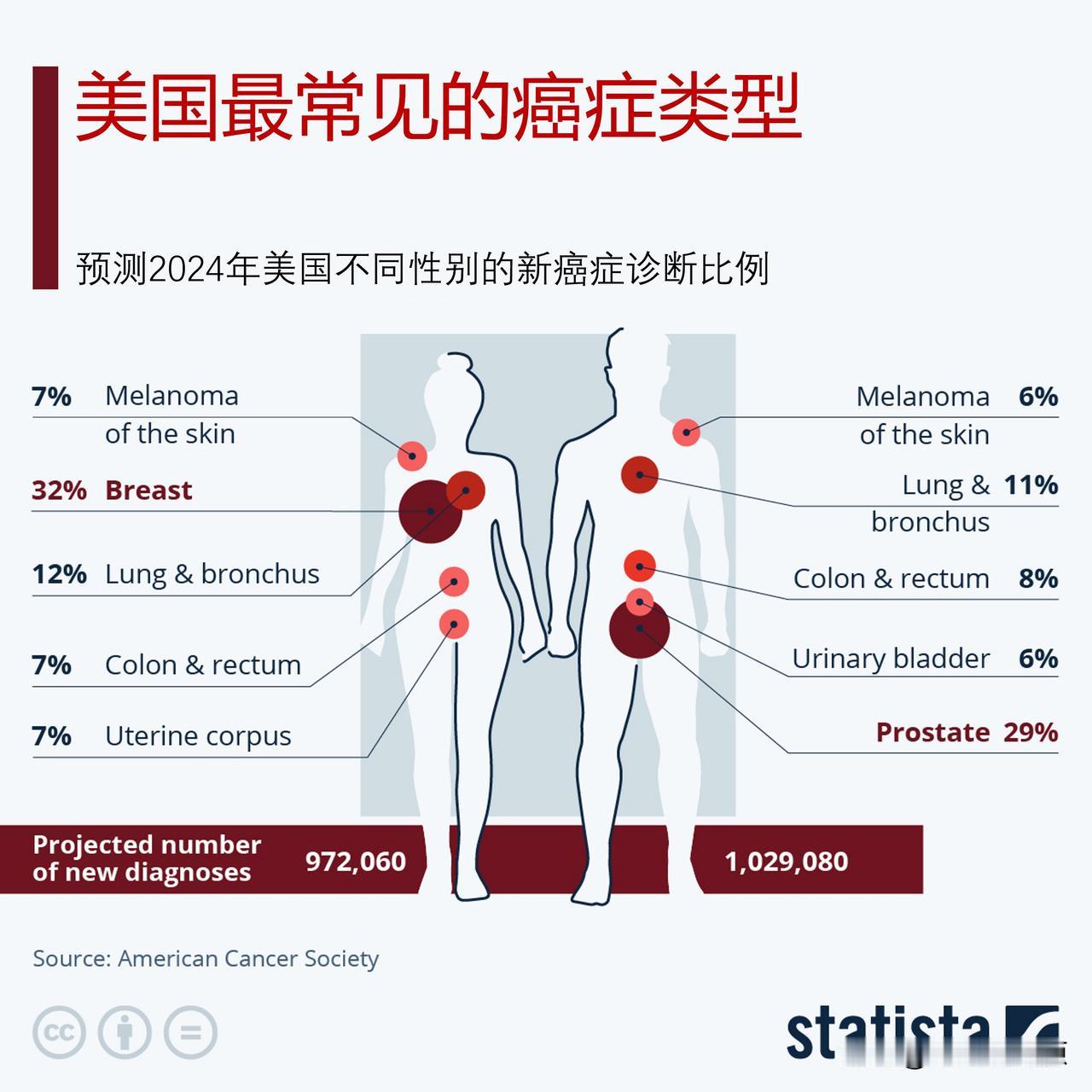 看看美国人最常见的癌症类型，与中国人癌症有什么不同？

心血管疾病仍然是全世界中