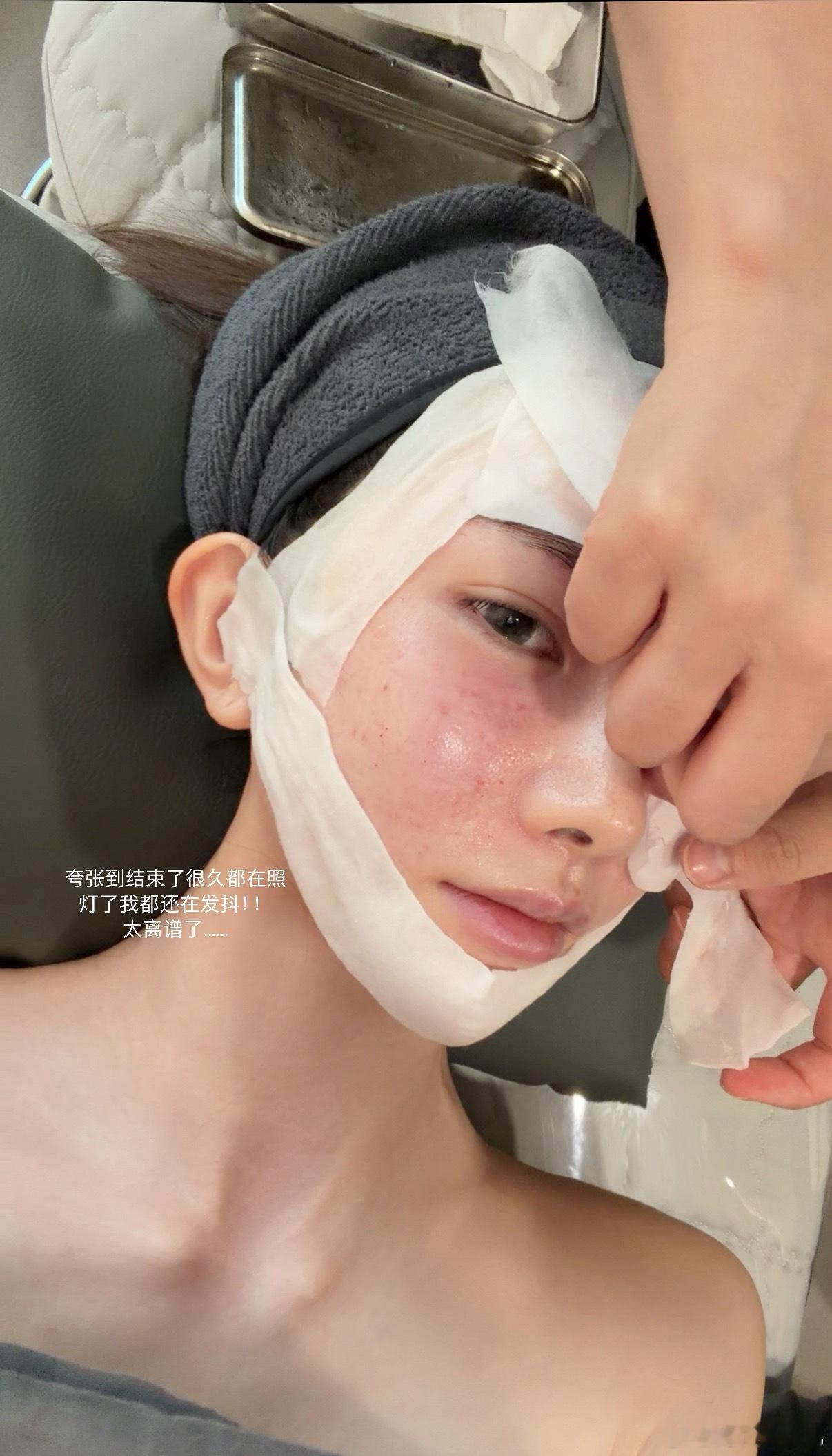 今天是人生第一次打水光针…痛到全程飙泪整个人抖得跟个筛子一样🧎打的还不是什么丽