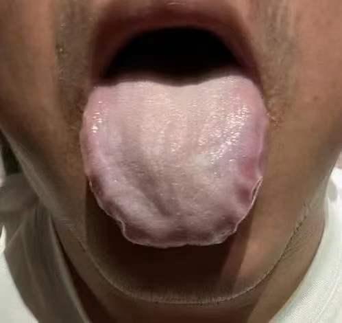 听我一句劝，凉的一口都别再吃了
管好你的嘴，再整天吃凉的冰的，你的情况会更棘手
