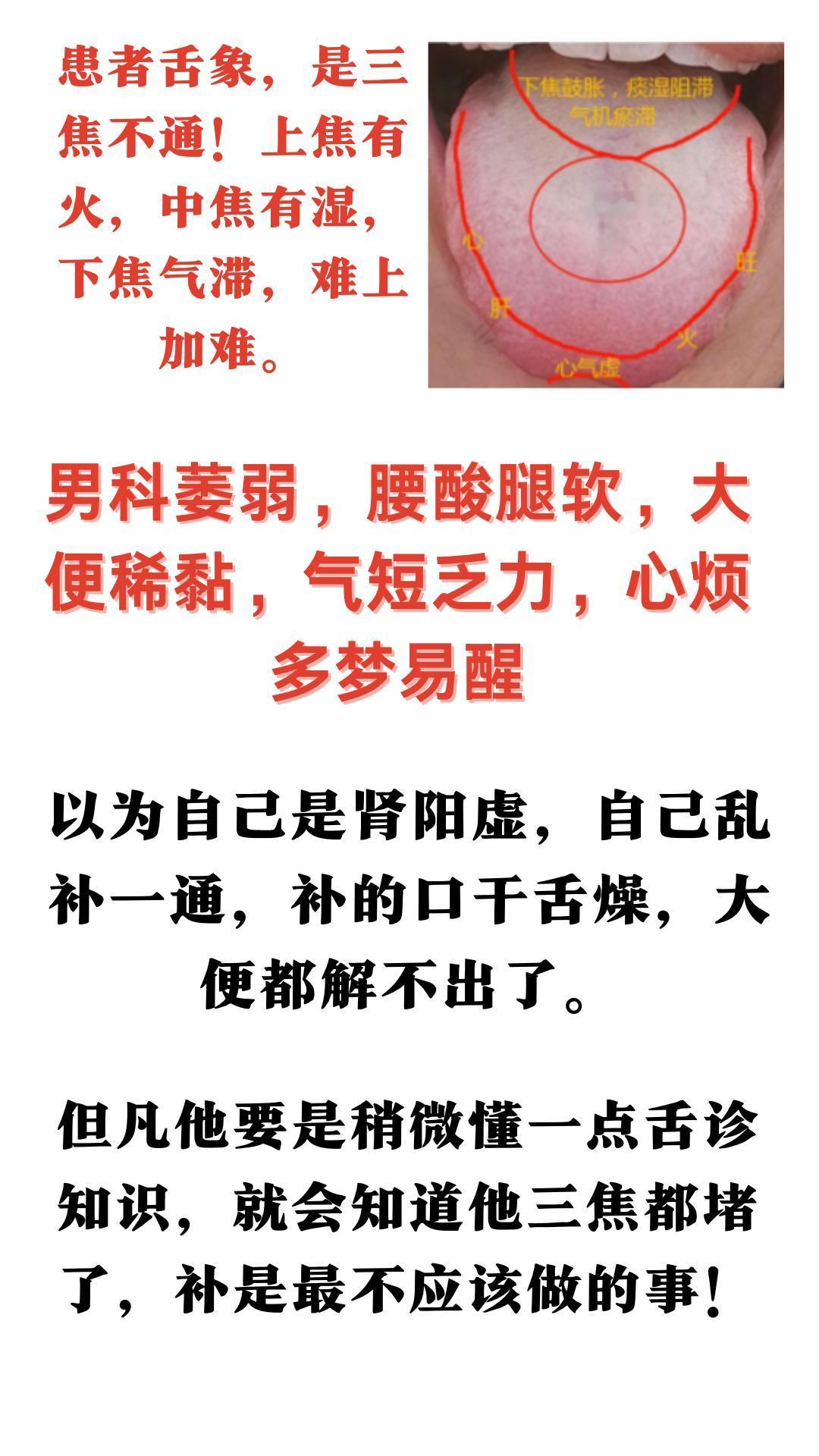 患者舌象，是三焦不通！上焦有火，中焦有湿，下焦气滞，难上加难。#中医##中药##
