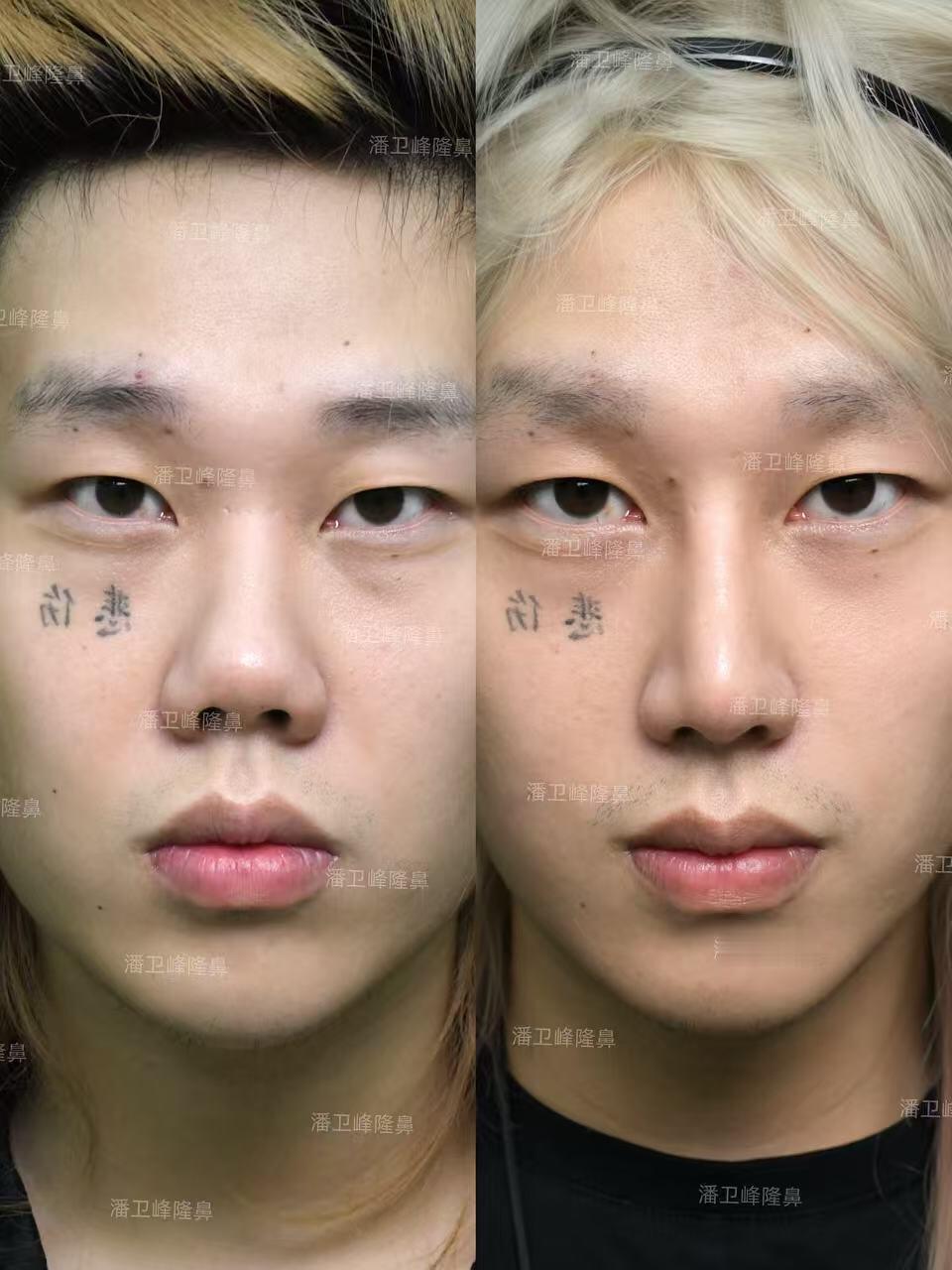 吉他张do脸前后对比图
