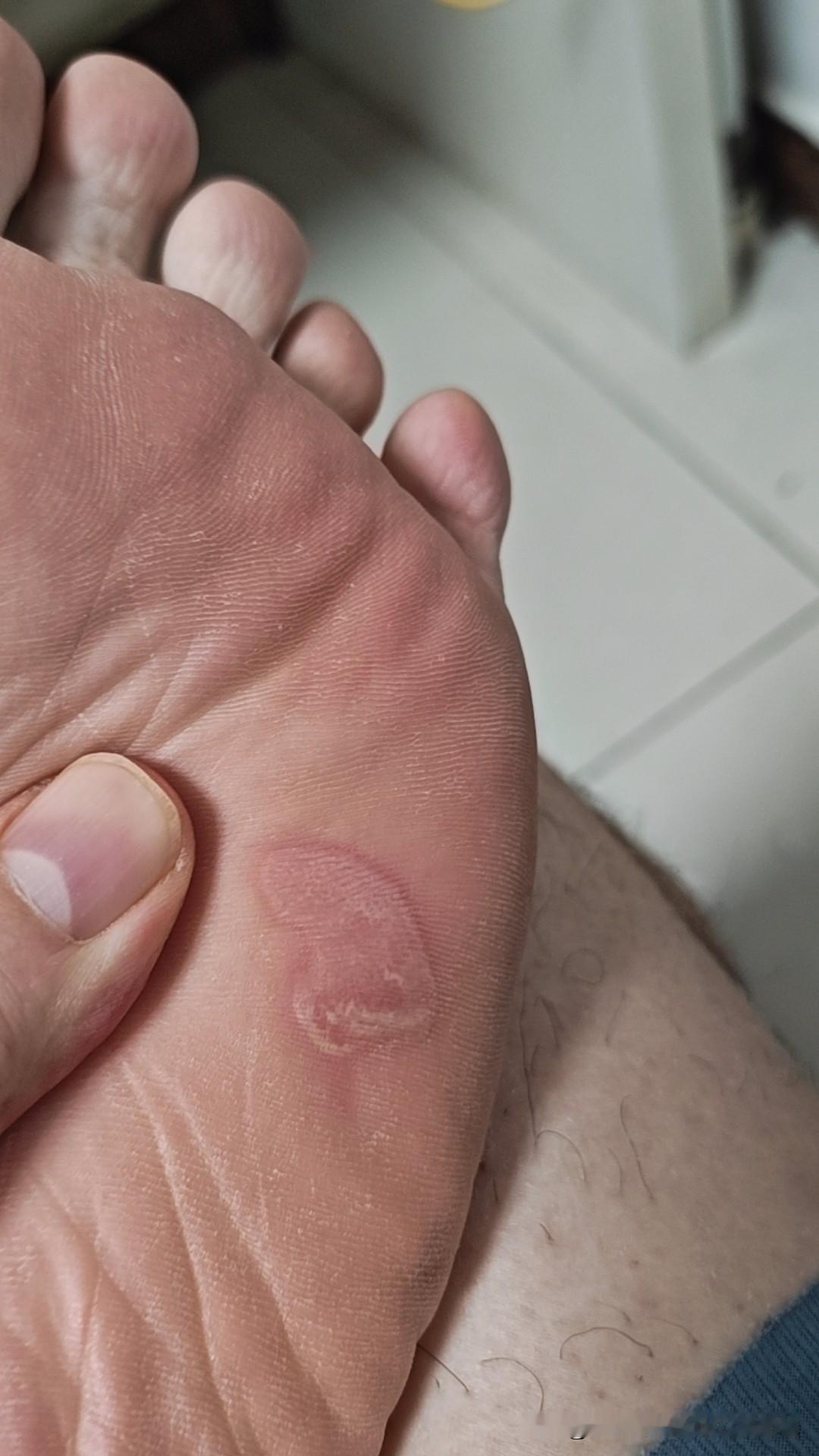 前几天我兴冲冲地用刚买的电动泡脚桶泡脚，本想缓解疲劳，结果却遭遇了“灾难”！那款