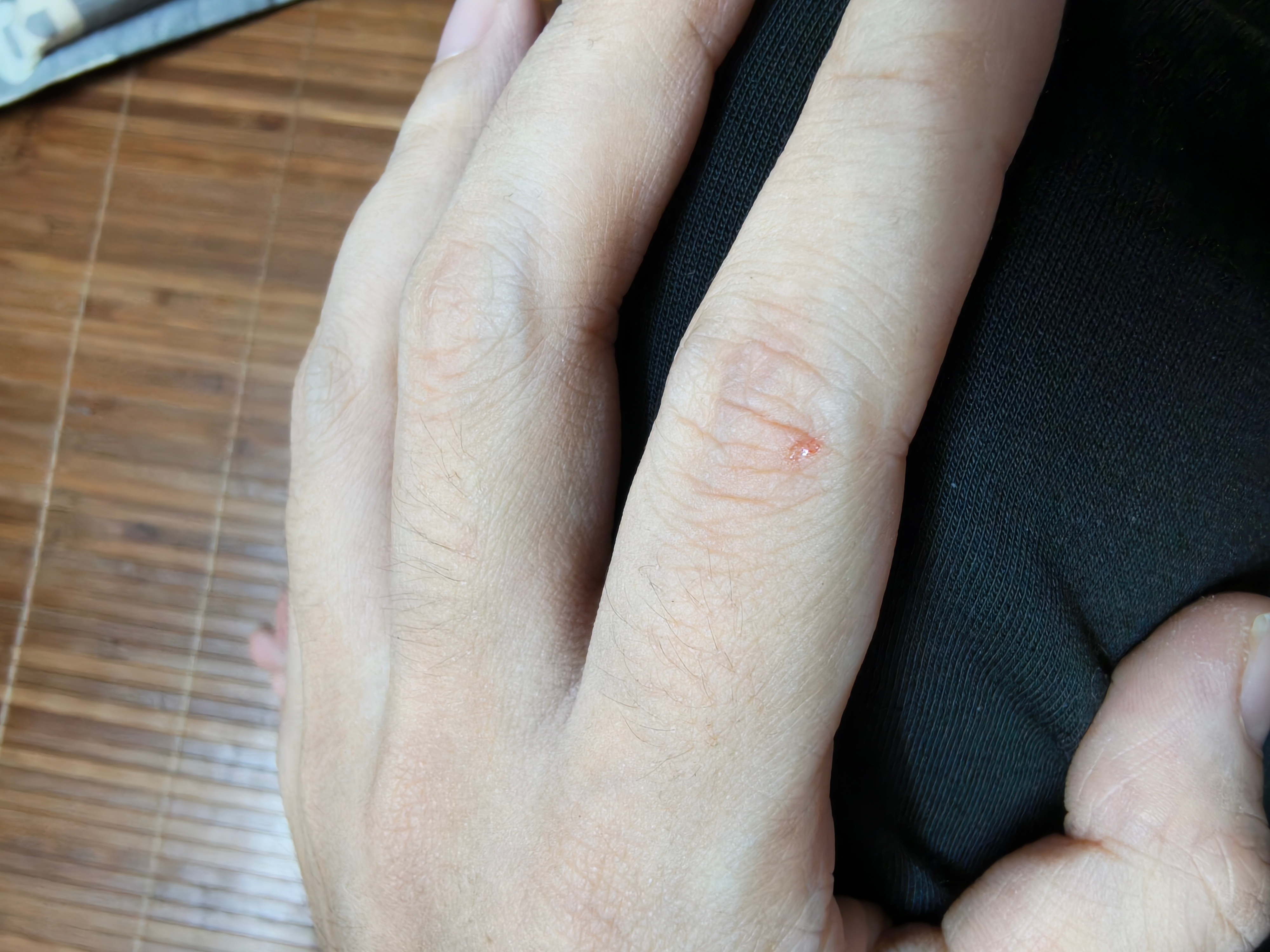 洗件衣服竟然洗掉了一块皮[苦涩]，不小心被指甲划到了[苦涩] ​​​