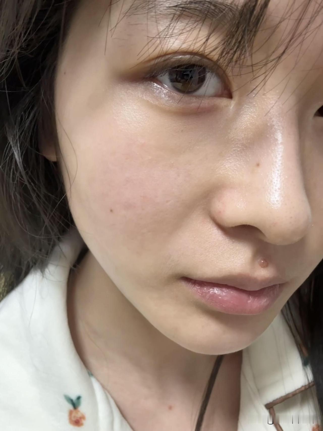 上班真的让人变丑，这法令纹还能救吗？
咱打工人真的太难了！每天不是对着电脑码字，