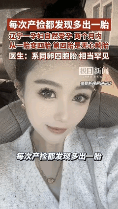 抚顺宝妈的产检堪称“开盲盒”！
30岁怀孕每月产检都解锁新惊喜，
从一胎到两胎再