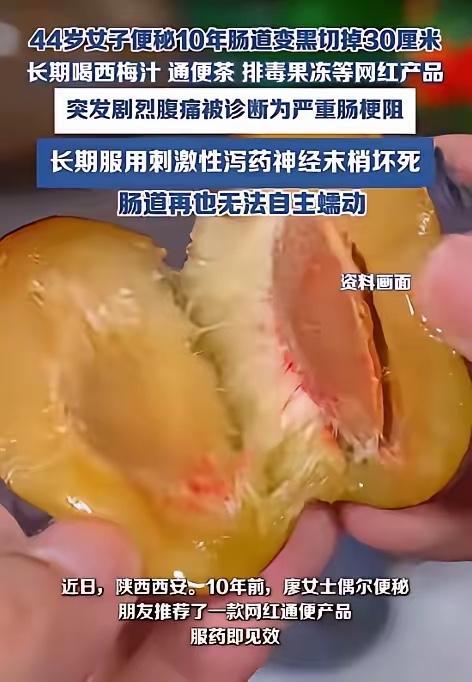 “偏方变毒方！”陕西廖女士的遭遇让人唏嘘不已——十年便秘史，竟因盲目相信“纯天然