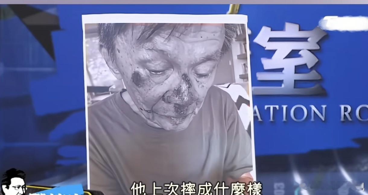 87岁的沈富雄摔一跤，脸部受伤严重身体却没有一处骨折，现在竟然又开始上节目了[赞