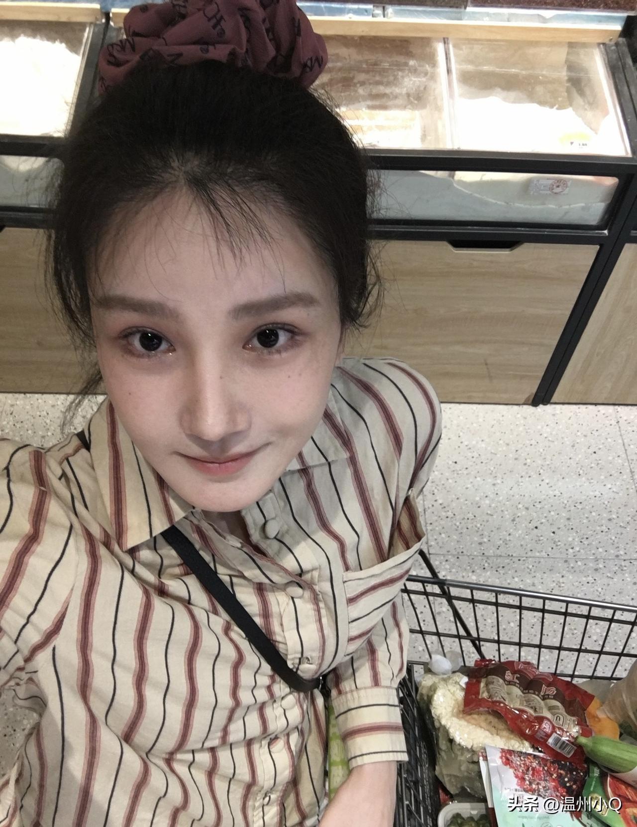 陈小纭的鼻梁虽然很高很挺，但山根处就很奇怪，假假的。