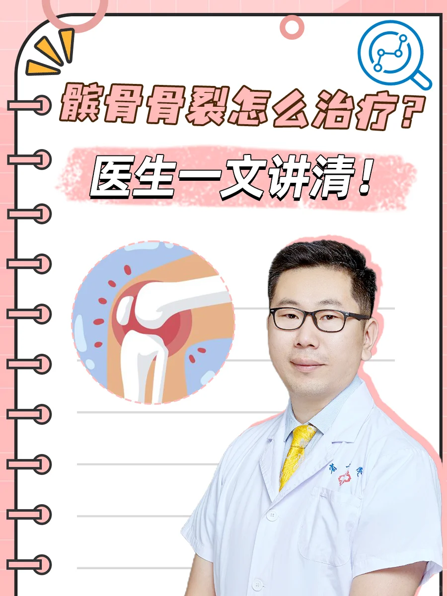 髌骨骨裂治疗最佳方案