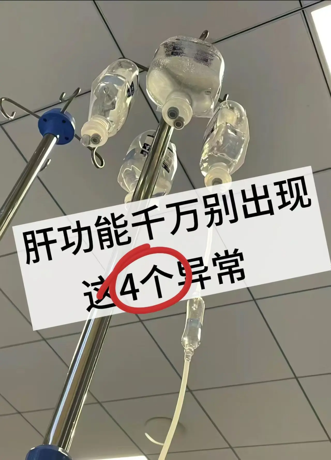 肝功能千万别出现这4个异常！肝功能异常是体检中或者是治疗中比较容易遇到...