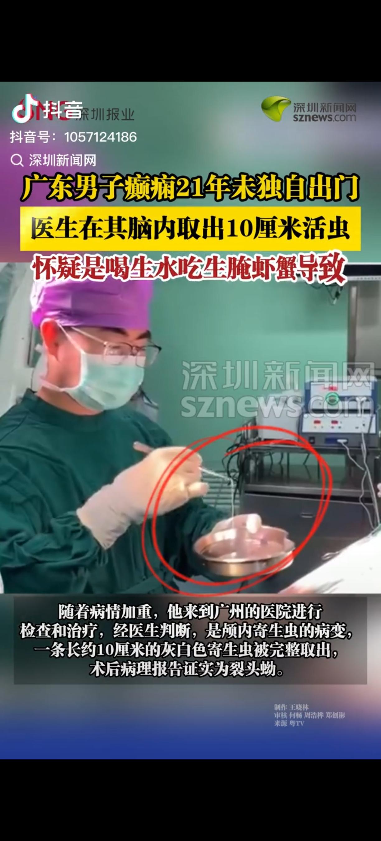 太吓人了，近日，广东广州，一男子因身体不适，前往医院就诊，自曝被癫痫困扰21年，