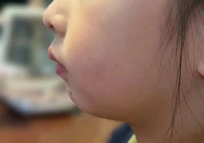【看了一辈子小儿腺样体肥大，快退休了说点心里话】
大家好，我是中医孟牛安。
从医