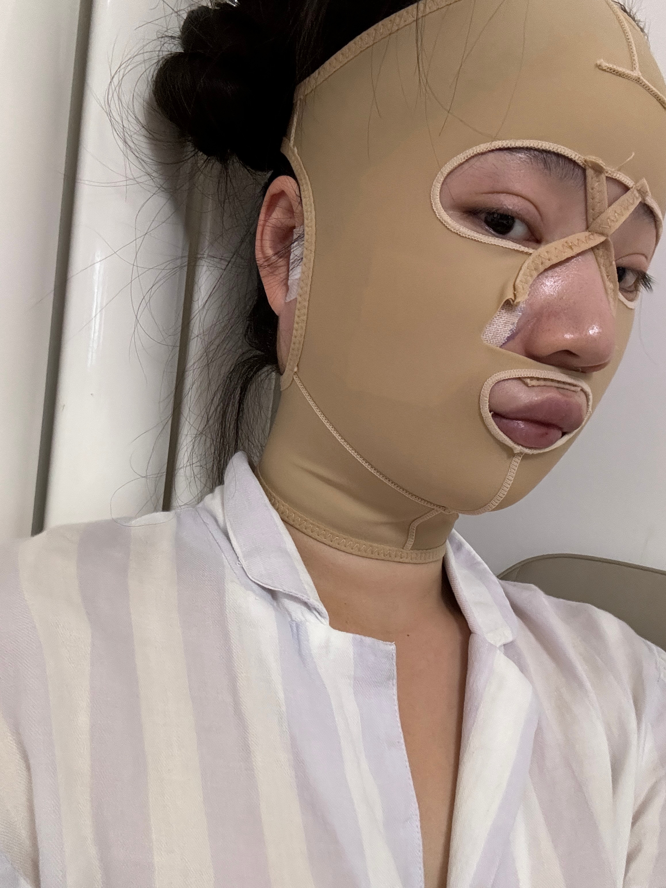 今天是第3天  吸过的地方不疼  但是带头套特别难受 勒得我脖子疼脑壳疼  以后
