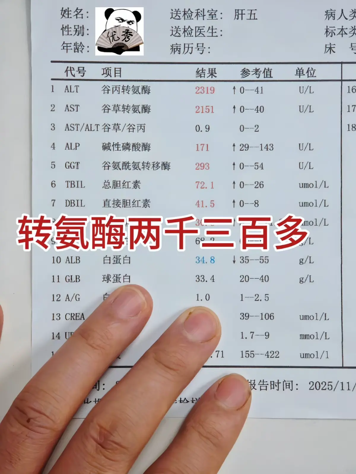 你见过这么高的转氨酶吗？ 让住院非吵着要回家！还说自己一点事没有。 大...
