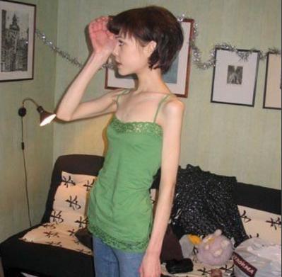 河南一90后女子为减肥辟谷，半个月不吃饭、只喝水，一个月瘦了40斤，代价是什么？