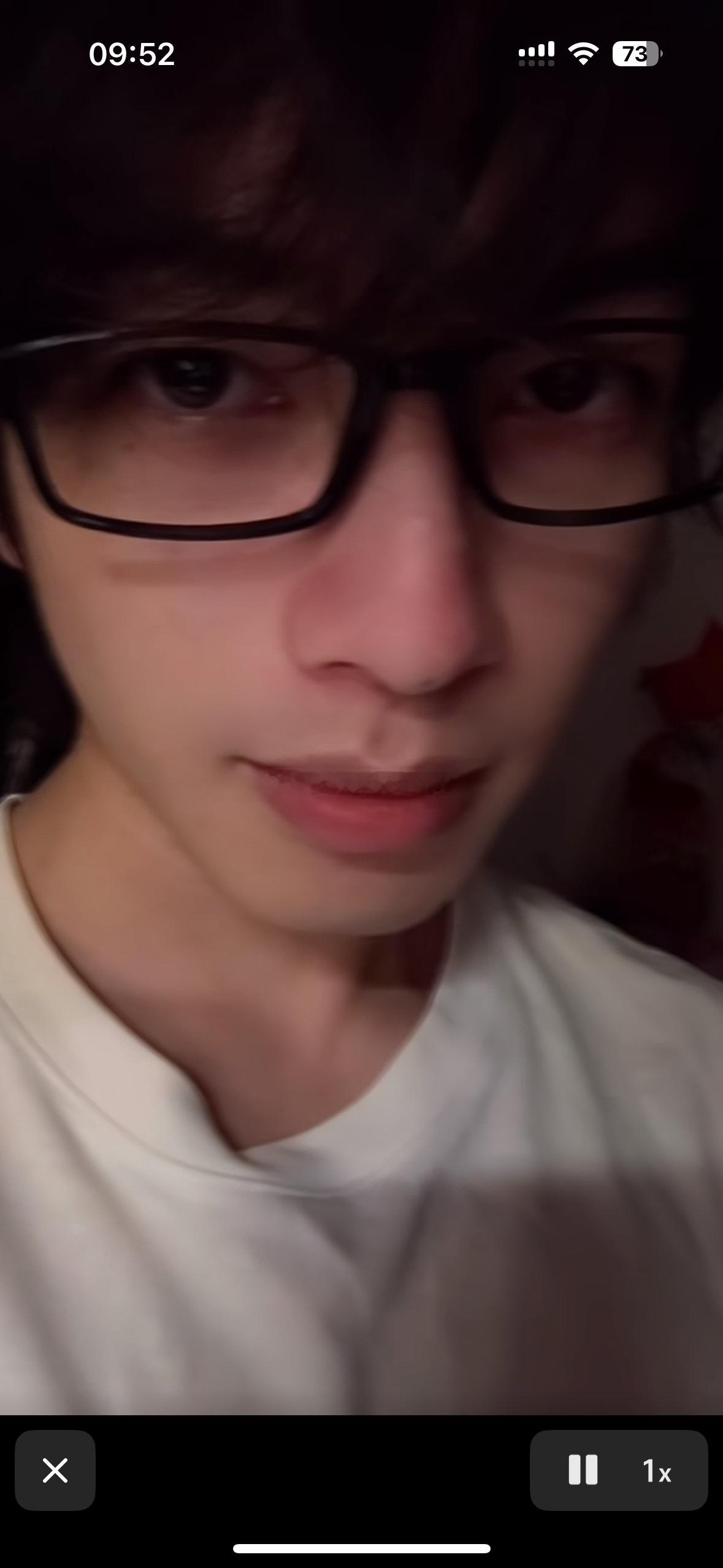 取向狙击