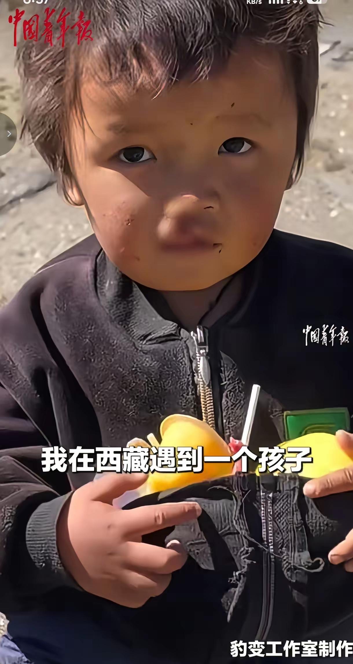 “积大德了!” 西藏日喀则，一名女子去旅行时，偶遇一位唇腭裂严重的男孩，他安静站