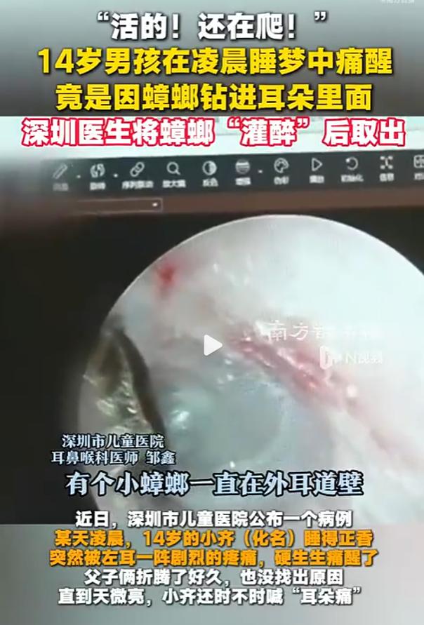 掏一下几十块，捅穿几千块：深圳男孩耳内活蟑螂，棉签为何是元凶？

据南方日报9月