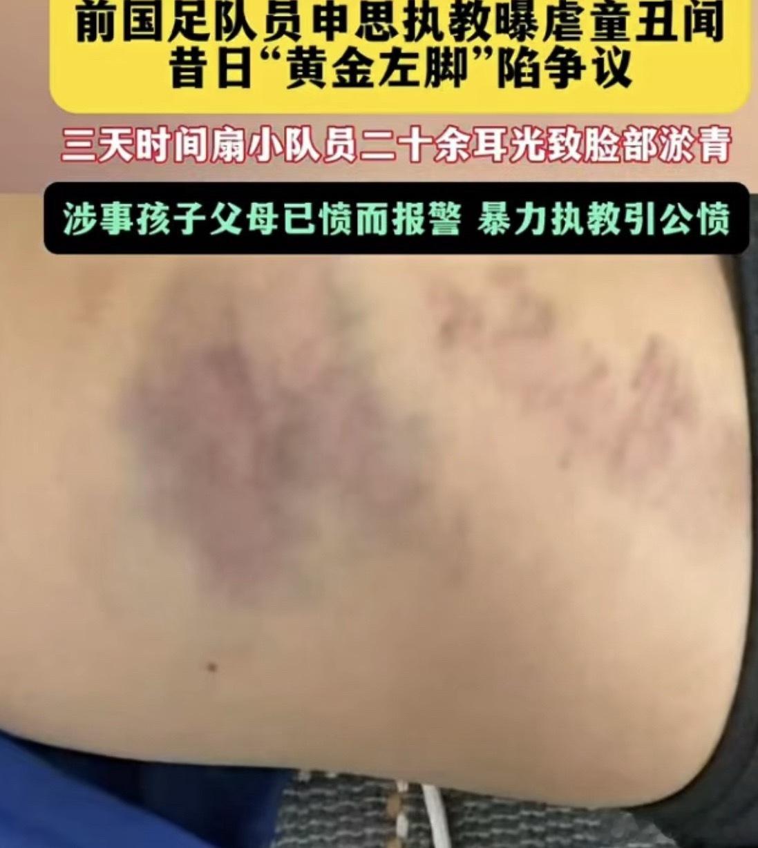 前国脚申思与祁宏因近期青训暴力事件被推上风口浪尖，中国足协在2026年7月18日