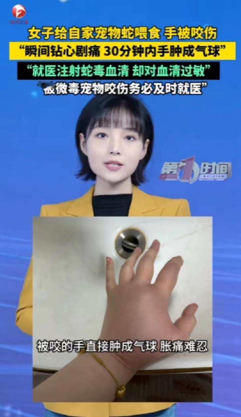 猪鼻蛇咬人手肿成气球，说无毒却差点窒息，到底谁在低估危险。

江苏淮安万女士喂自