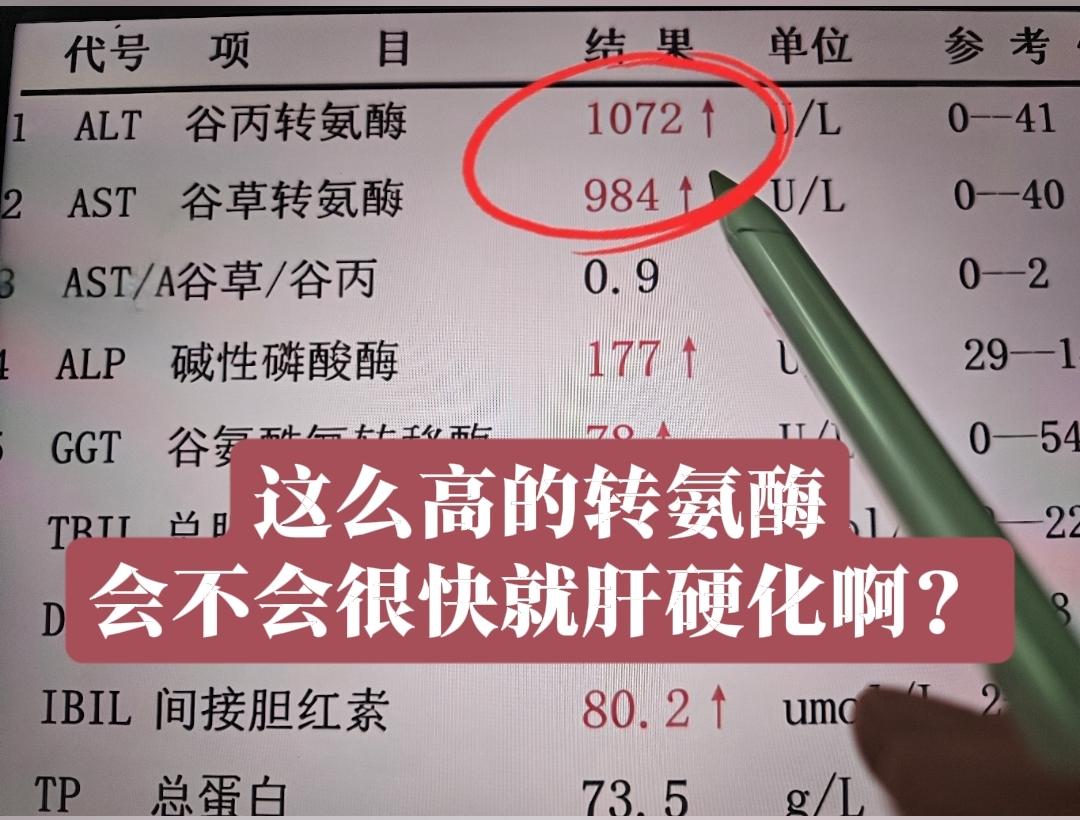 教授，我看着我的谷丙转氨酶都1000多了，是不是很快就肝硬化了啊？您救...