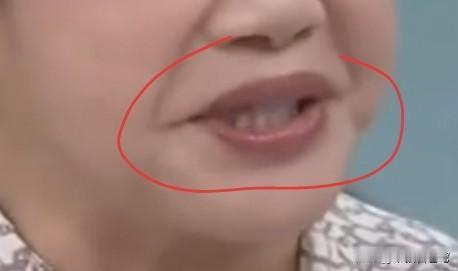 图片上就是台湾廖美然的大臭嘴巴！台湾廖美然的大嘴巴果然厉害，她的嘴巴为什么这么厉