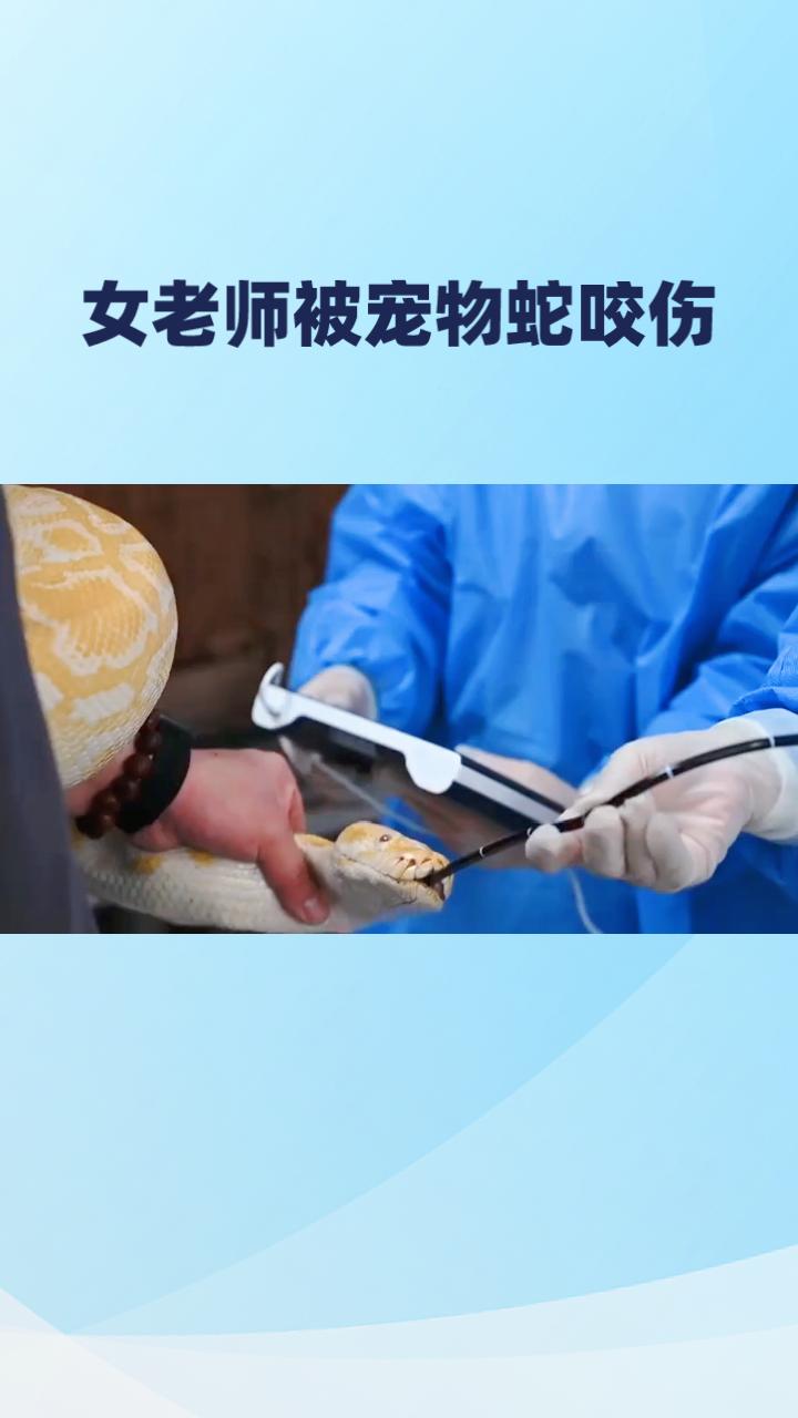 女老师被宠物蛇咬伤，为何能如此淡定处理？
2025年4月，美国加州一名女子在徒步