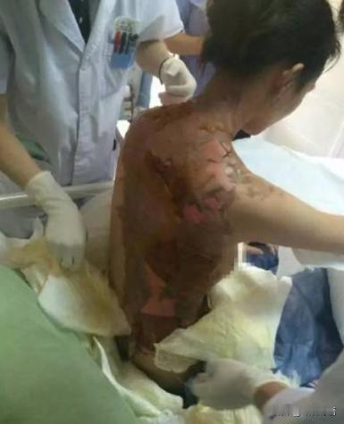 “这就是嘴欠的下场”！2015年浙江一女子在火锅店要求加汤，因店里客人繁忙，服务