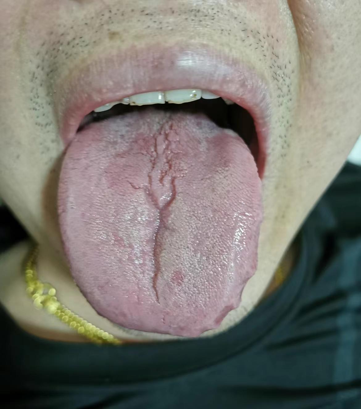 你到底干啥了？这胃这肾，也太虚了吧[发怒]
病友主诉：一到晚上有想法，时间却短
