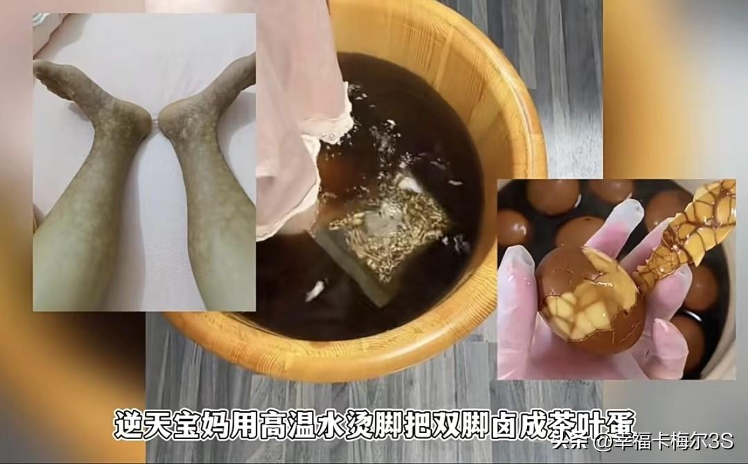 广西一位逆天宝妈高温泡脚把脚泡成“茶叶蛋”，血管都快成血肠了

这宝妈看别人泡脚