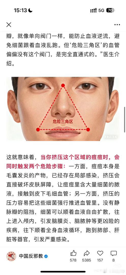 一个爱挤痘痘的人天塌了三角区的痘痘，千万不要用手挤！这个区域被称为“危险三角区”