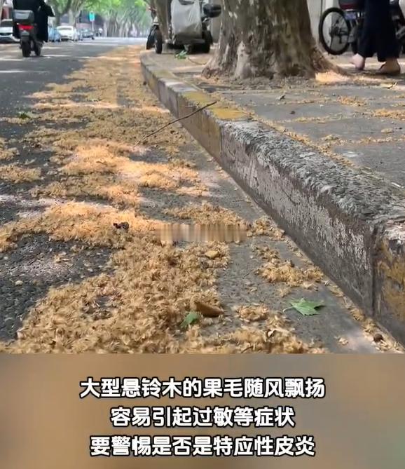 #上海换季易发痒可能是身体在预警#以大家出门什么的还是要做好一些防护，避免出现身