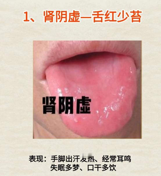 4 种舌象，分清阴虚阳虚与气血不足
