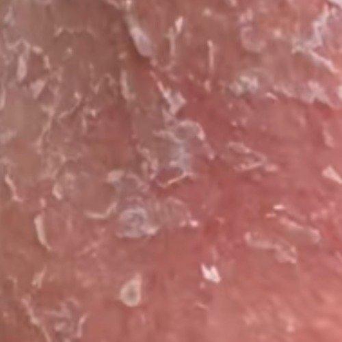 最近福州的林女士可真是遭了大罪——她看网上“以油养肤”特别火，说能快速缓解皮肤干