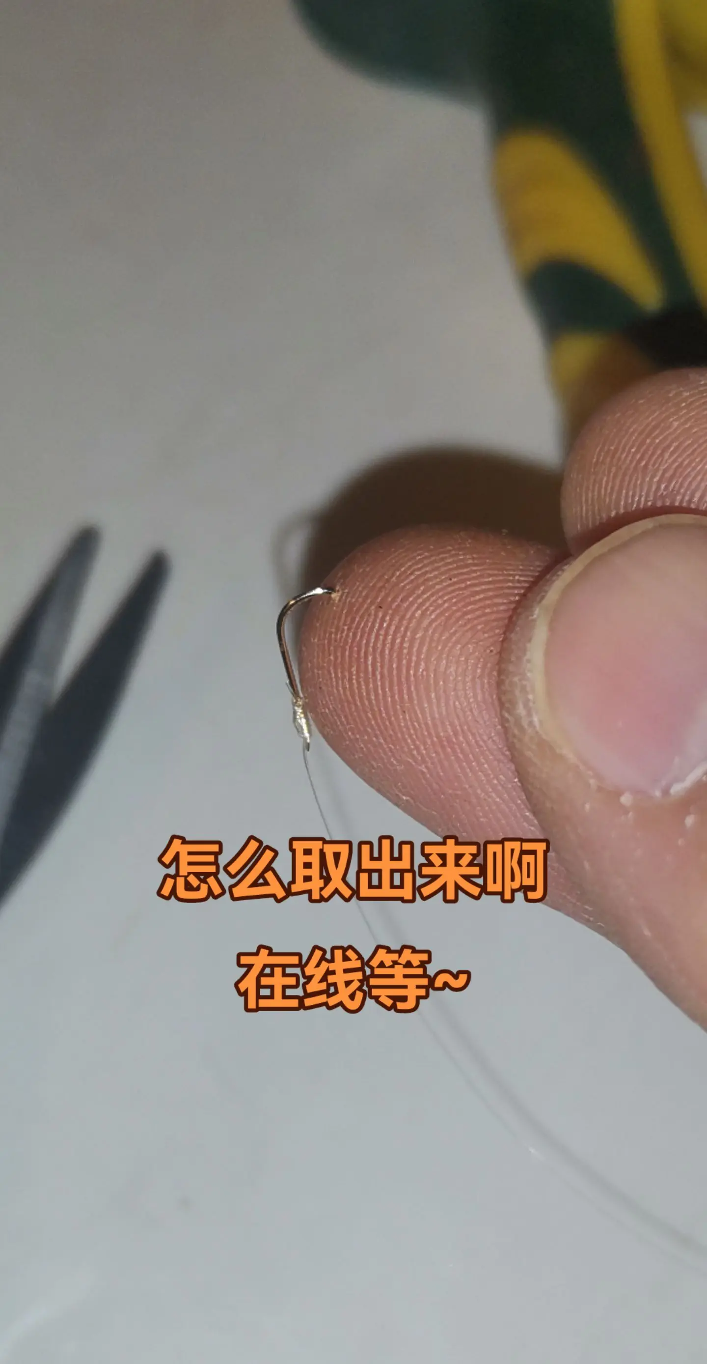 鱼钩扎到手，带倒刺，怎么取出来啊？在线等！钓友的快帮忙想下解决方法。😭
