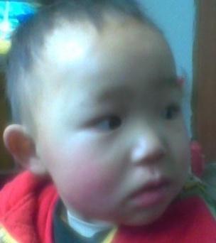 占梦琴，女，2008年出生2010年在浙江省杭州市淳安县临岐镇失踪。左腿膝关节外