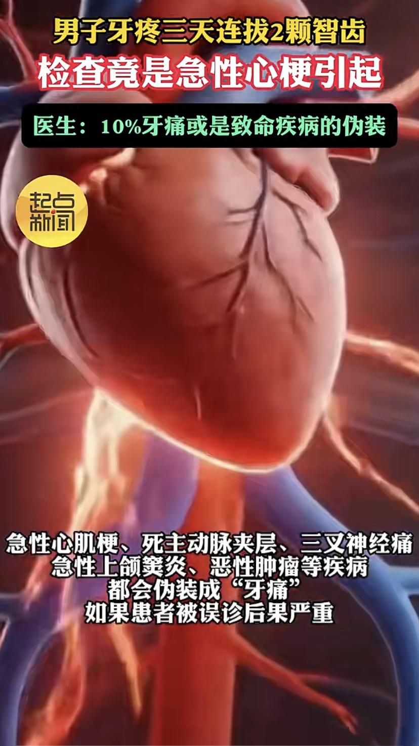 38岁广州张先生，牙疼了三天，直接去医院拔了两颗智齿。可疼痛一点没减轻，第四天他