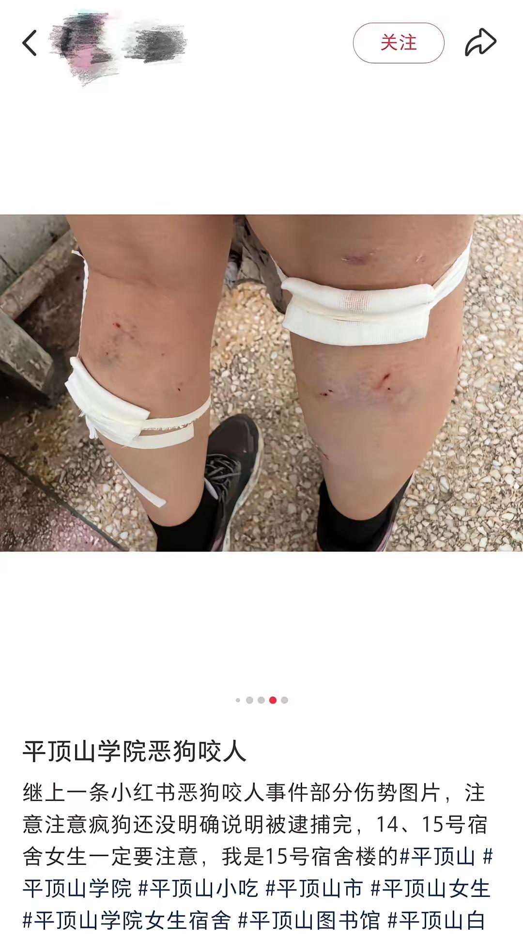 这也叫回旋镖？这不该叫回旋镖吧。
平顶山学院2024年开除了清理流浪猫的保安，结