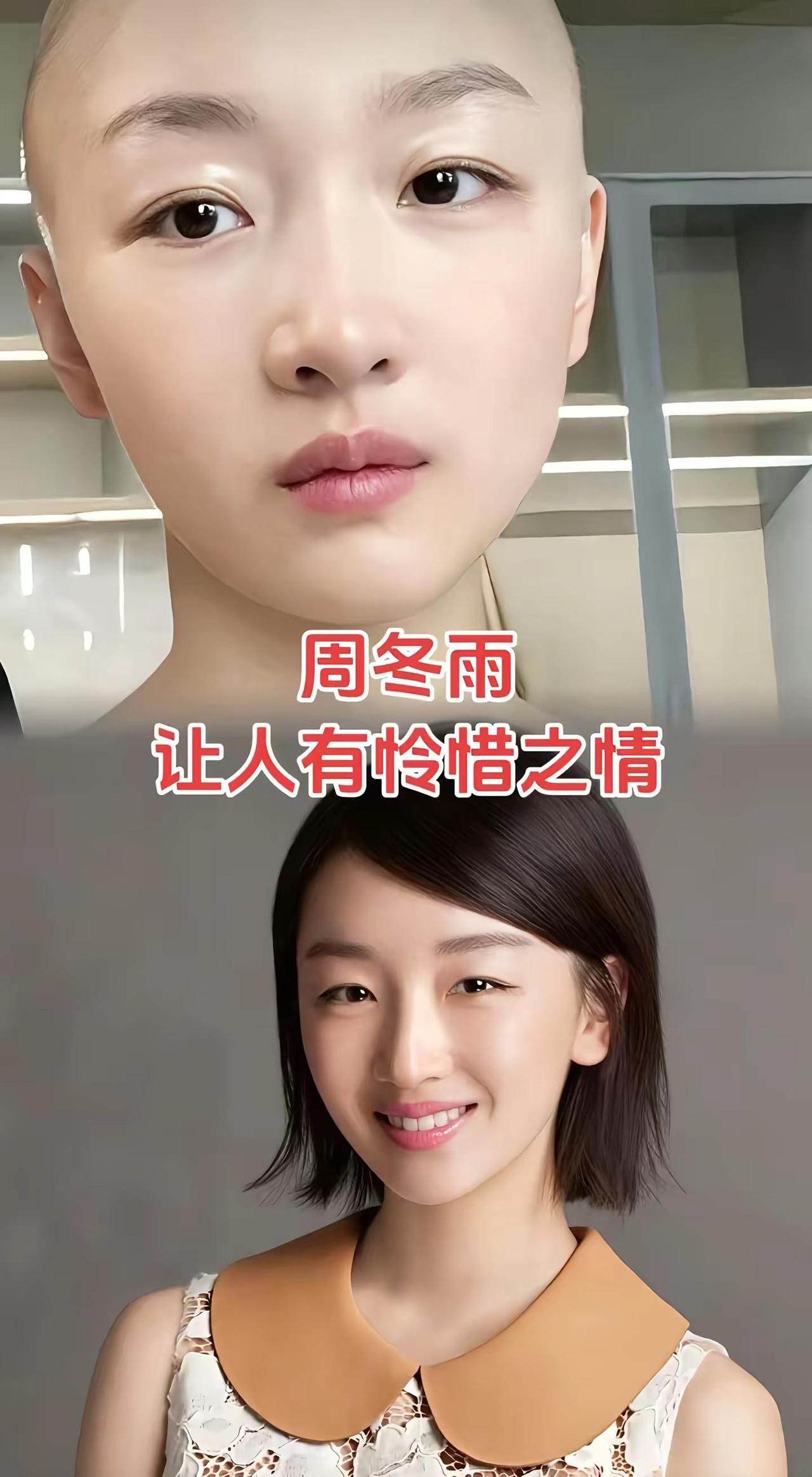 不是所有女生都适合演光头。不是所有女生都适合演光头明星盘点 影视 明星背后故事 