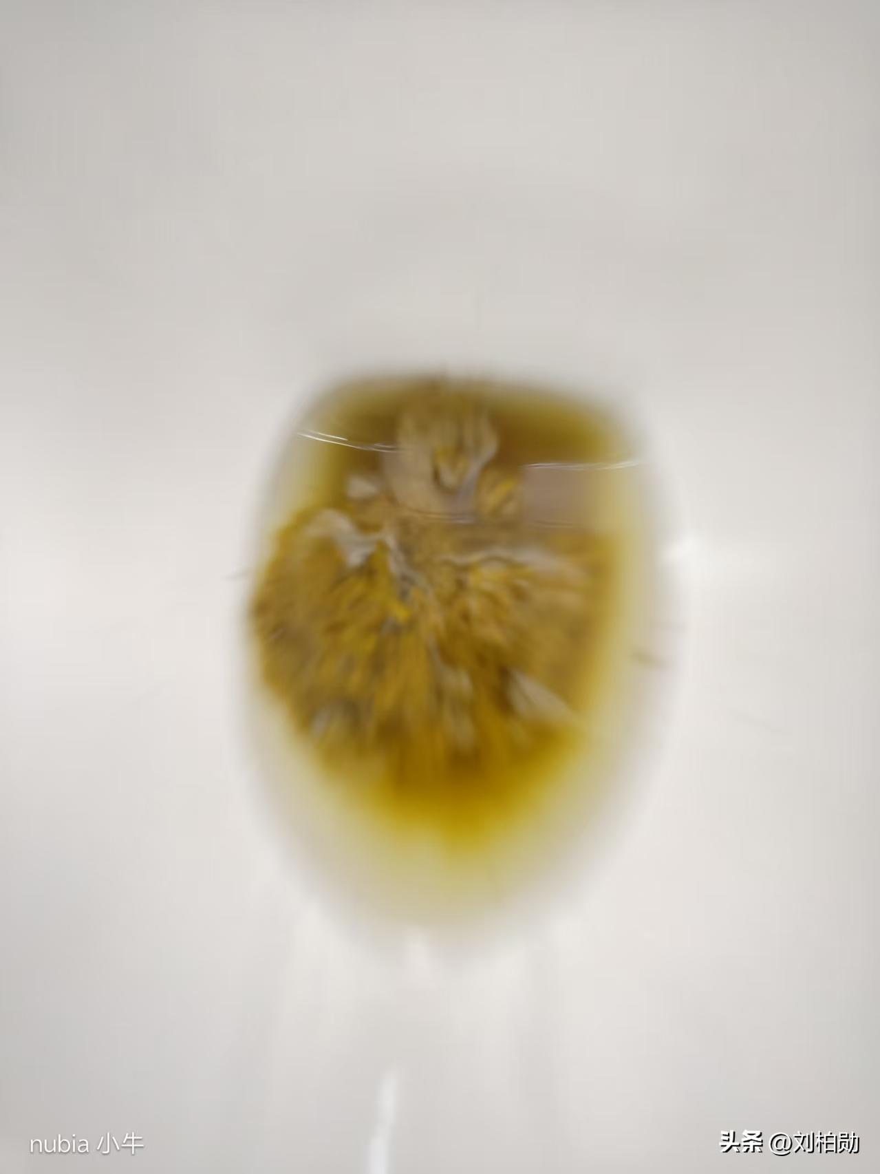 看完再也不敢乱冲马桶了！马桶里这团“黄糊”，可能是身体在喊救命！
 别嫌恶心！你