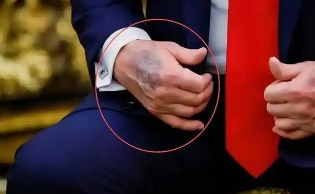 不管特朗普去世的消息是真是假，但可以肯定，他的健康状况已经出了大问题。
2025