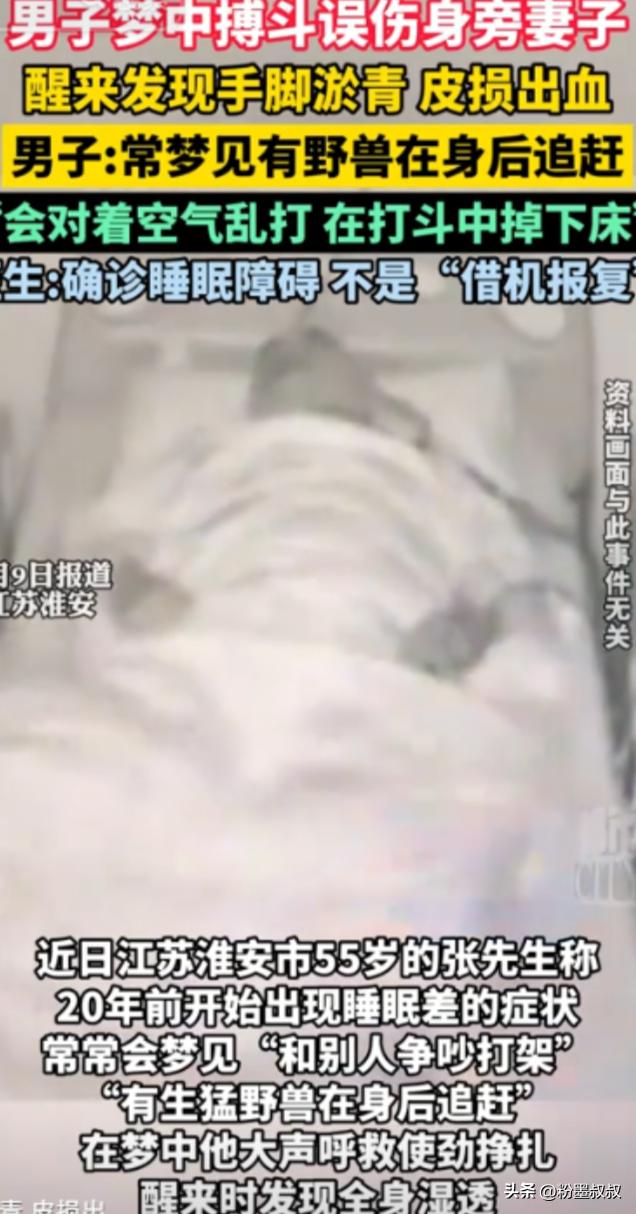 “这是真吓人！”近日，江苏淮安，一女子睡醒后发现自己满身淤青，甚至还有皮损出血，