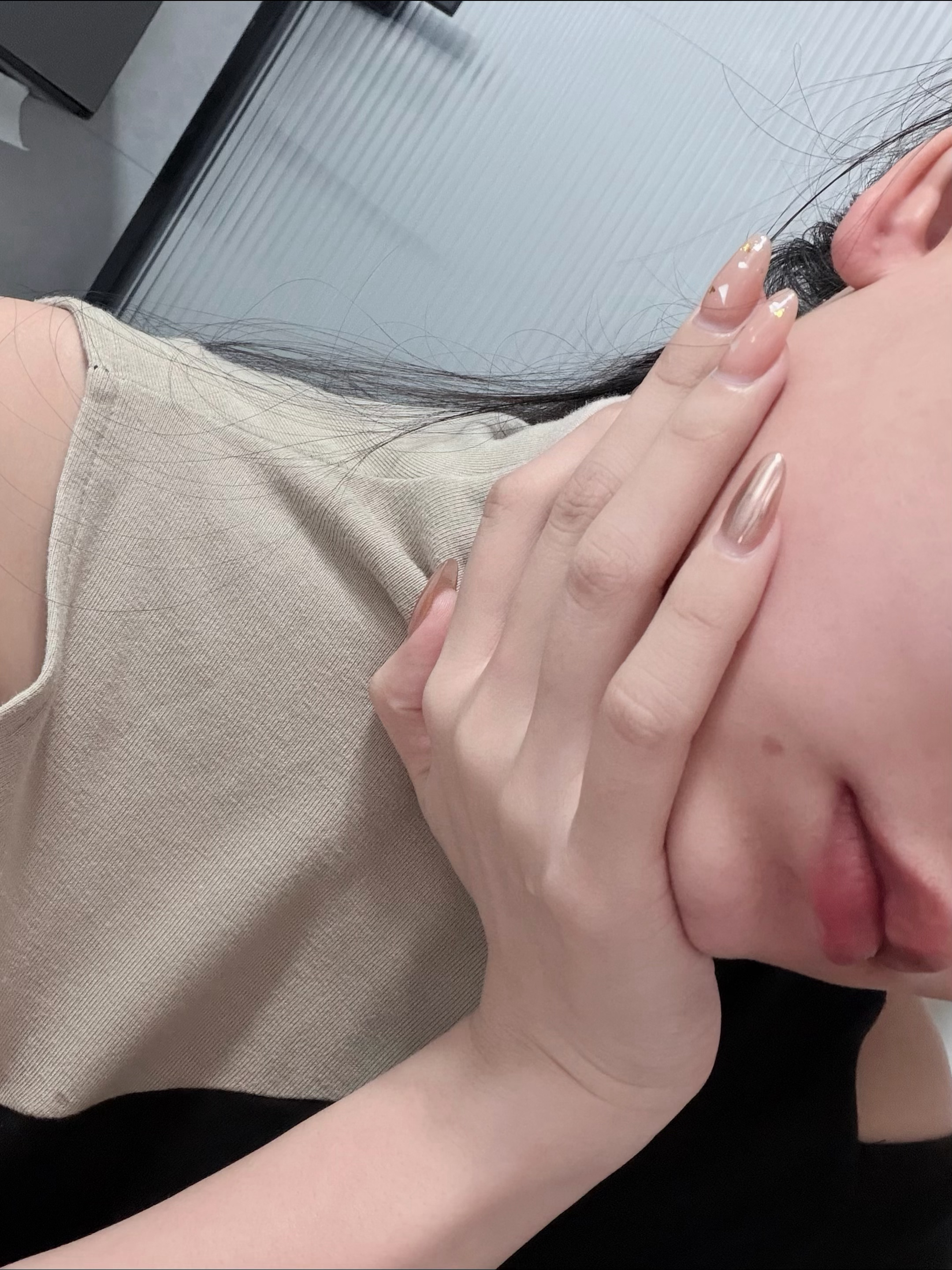 下巴被🚬烫的印子  卸完妆看真的很像一颗媒婆痣