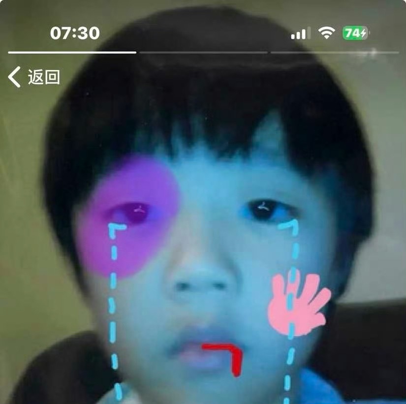谁把我儿子打成这样？ 