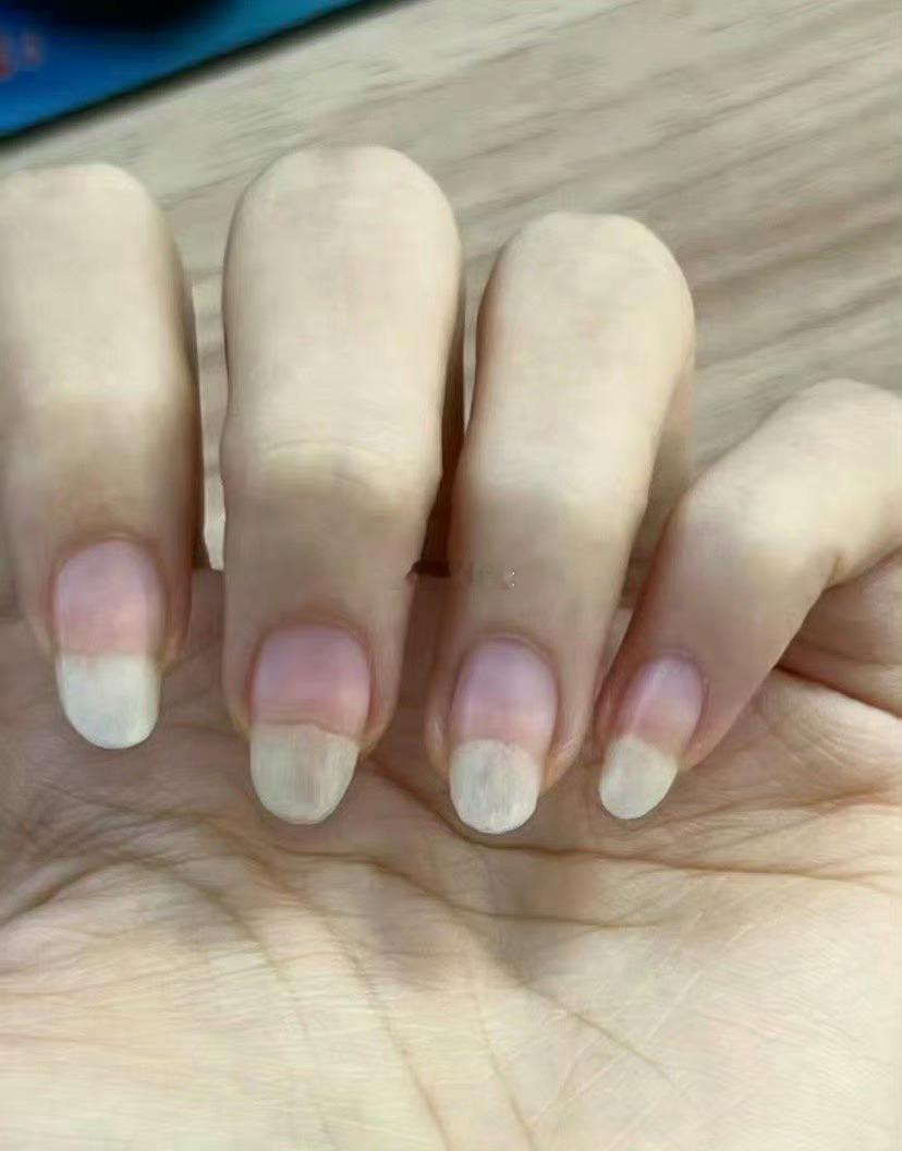 指甲都这么长了，为啥游离线就是养不出来？ 